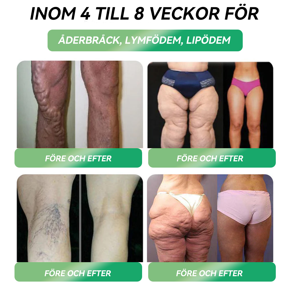 HHVB® Endast 10 flaskor kvar! Njut av extra 30% rabatt! Experter rekommenderar 4-5 flaskor för bästa resultat, vilket hjälper dig att nå dina mål snabbare. Säkra din idag – detta erbjudande kommer inte tillbaka förrän nästa år!