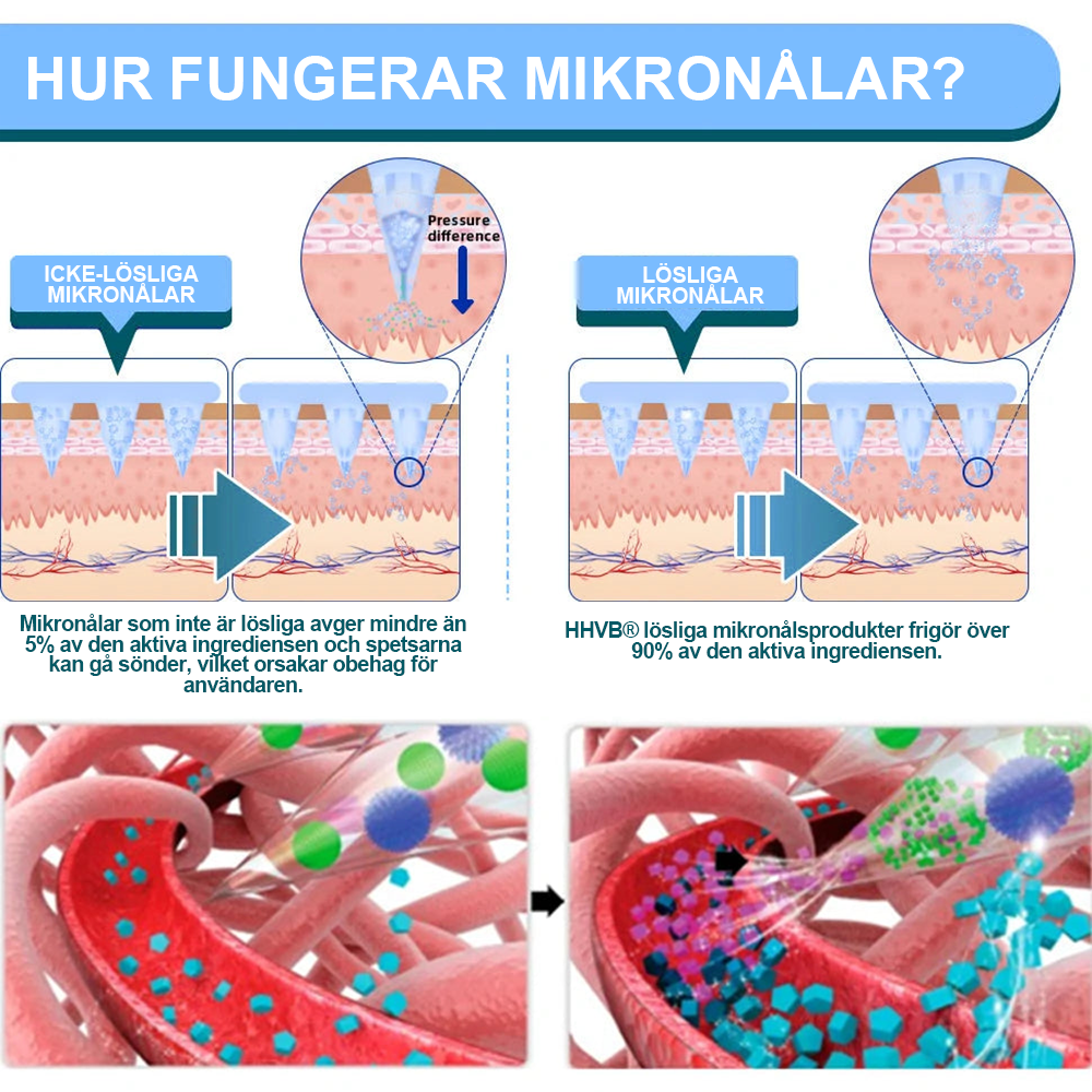 【Sista kampanjdagen: 70 % rabatt】𝐇𝐇𝐕𝐁®🌿 Nano-mikronålsplåster med NIDDK-Tirzepatid 🌟 (Smärtfri, lindring dygnet runt | Gå ner 9 kg SNABBT | 90 % minskning av socker)