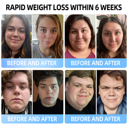 ⏰⏰ Only 4 bottles left! Enjoy an extra 30% off! Experts recommend 4-5 bottles for best results, helping you reach your ideal body faster. Grab it now before this offer comes back next year!